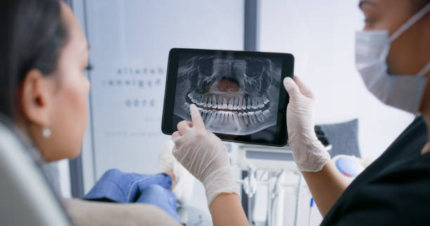 Licensed Tooth Extraction service in San Carlos, CA - Smile Center Dentistry